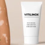 Vitilinox: The Complete 2026 Guide to Natural Vitiligo Treatment, Ingredients, Results & Safety